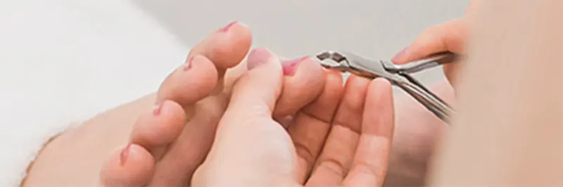 巻き爪カットケアを行なっているイメージ