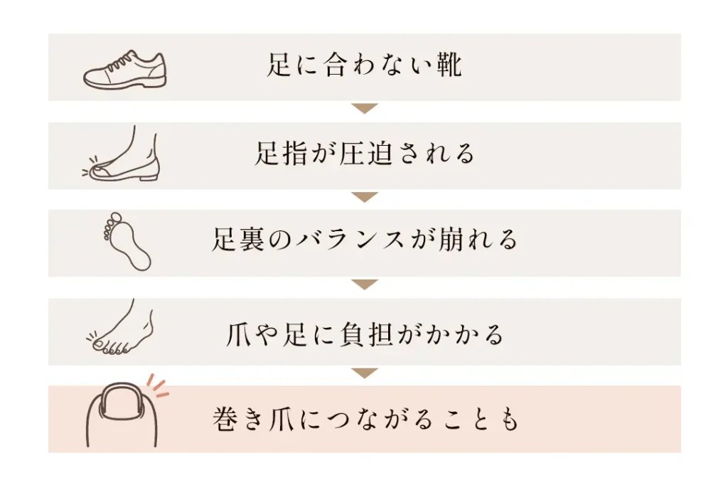 巻き爪を繰り返す原因のイメージ図